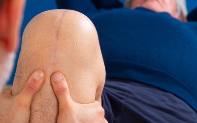 Sinovite al ginocchio: cos’è e come si cura